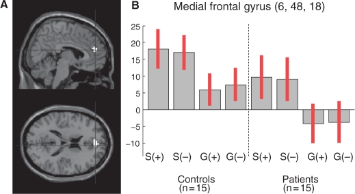 Fig. 1