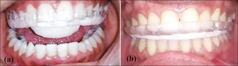 Figure 2: