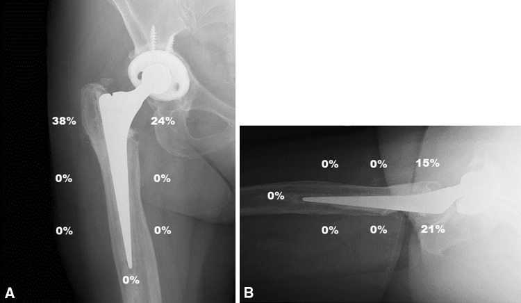 Fig. 5A–B