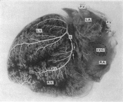 Fig. 13