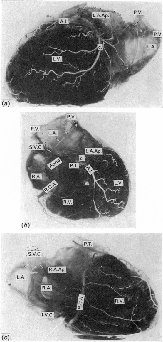 Fig. 11