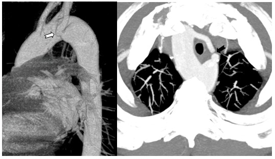 Fig 3.