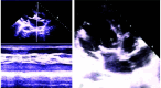 Fig. (2)