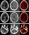 Fig 2