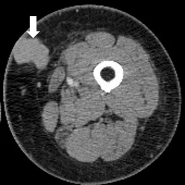 Figure 2a: