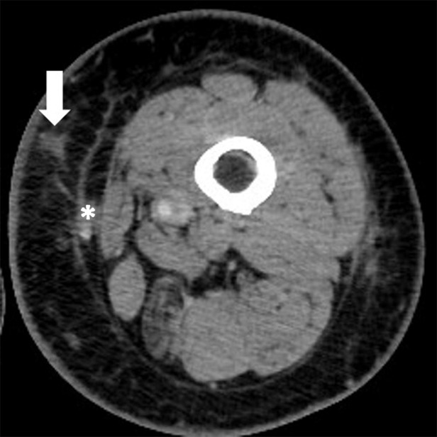 Figure 3c: