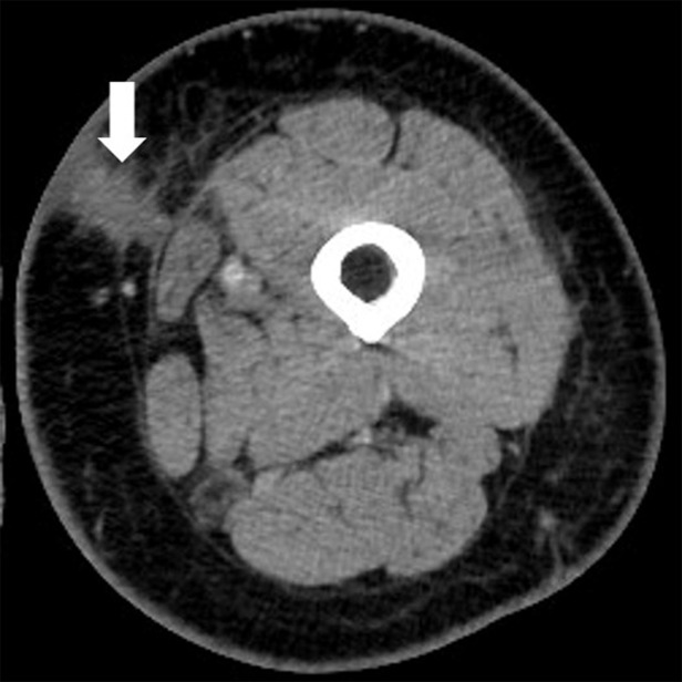 Figure 2c: