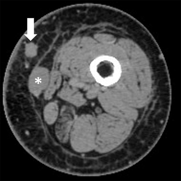 Figure 3b: