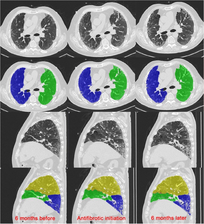 Fig. 4