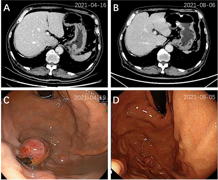 Figure 2