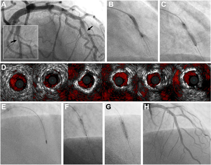 Figure 3