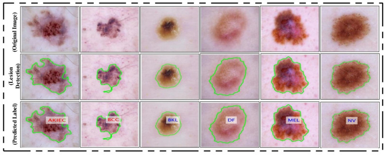 Figure 15