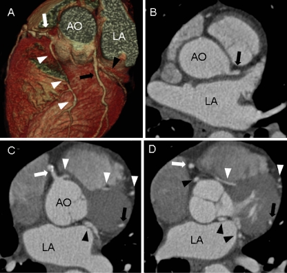 Fig. 1