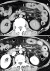 Figure 3 (A and B)