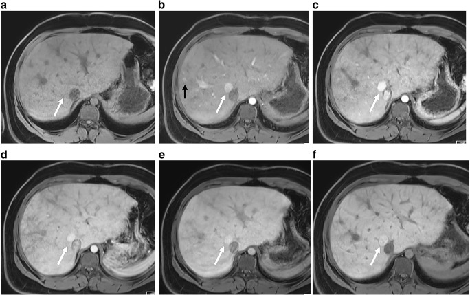 Fig. 11