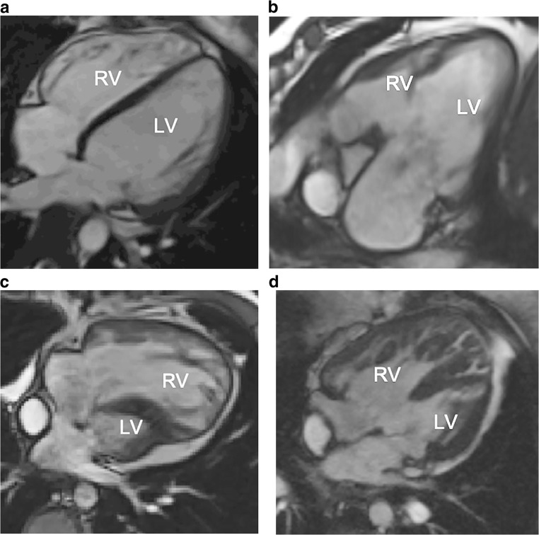 Fig. 4