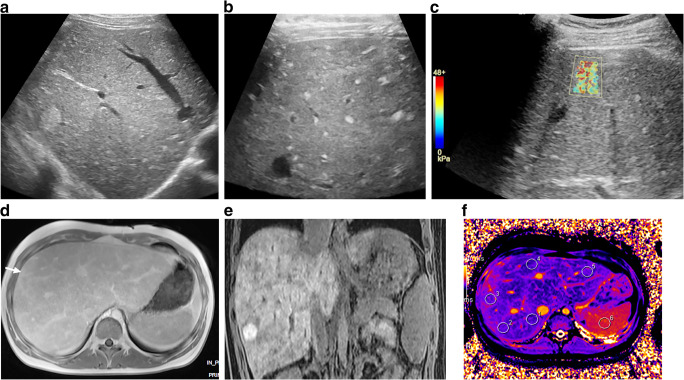 Fig. 10