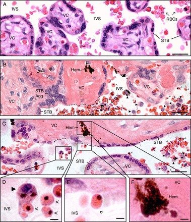 FIG. 1