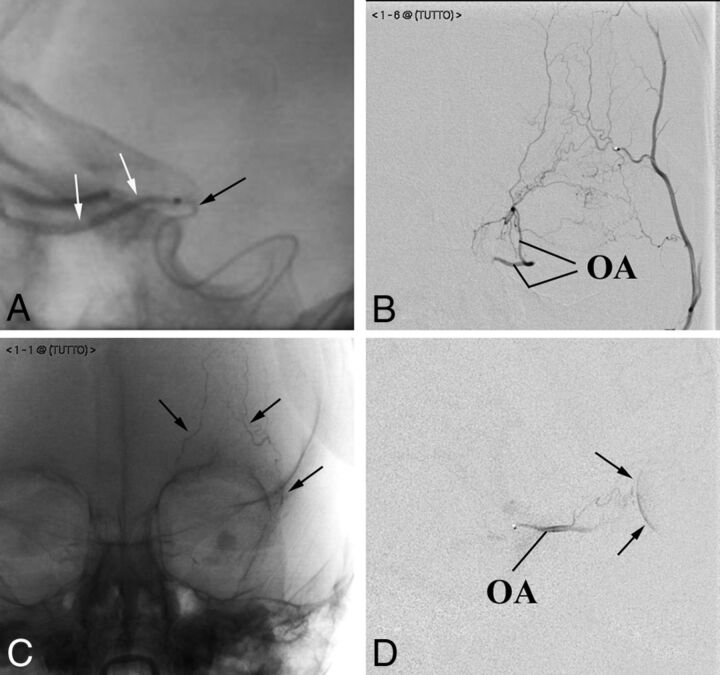 Fig 2.