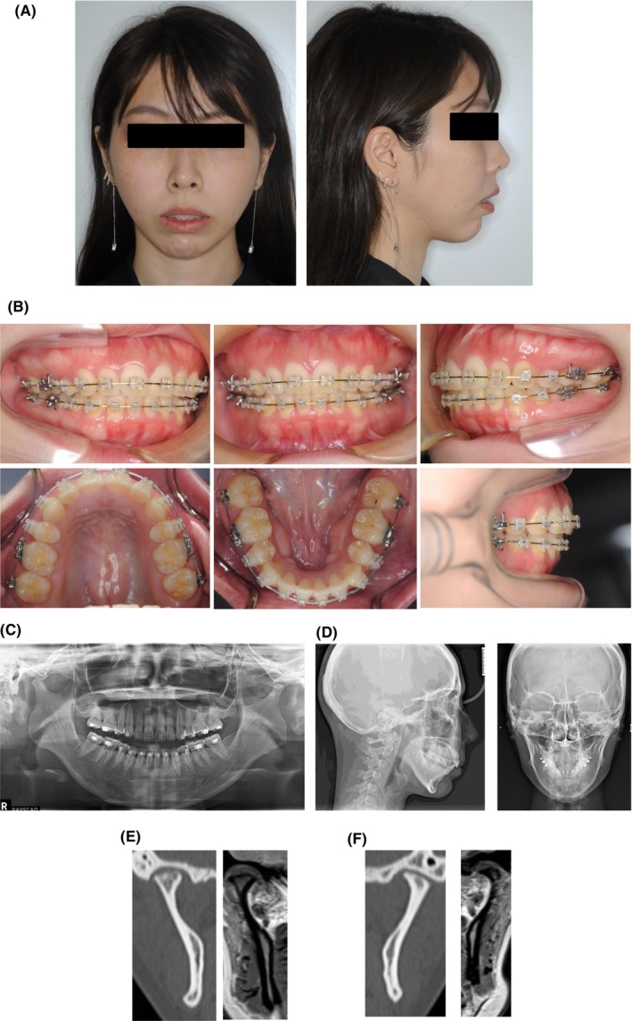 FIGURE 2