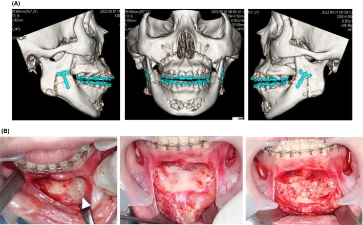 FIGURE 4