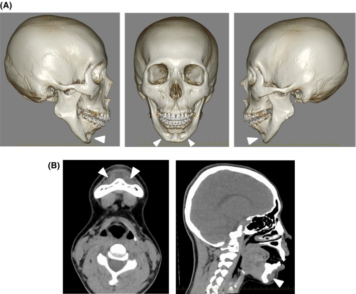 FIGURE 3