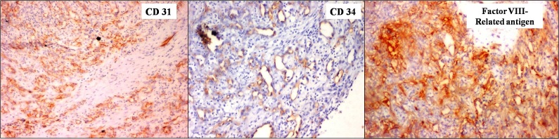 [Table/Fig-4a-c]: