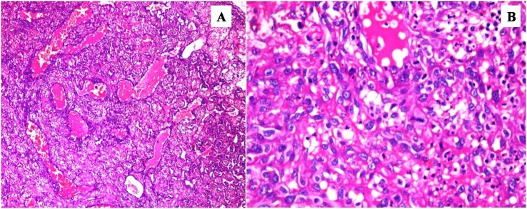 [Table/Fig-3a,b]: