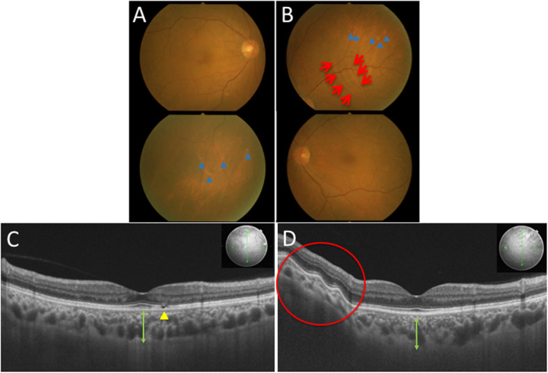 Fig. 1