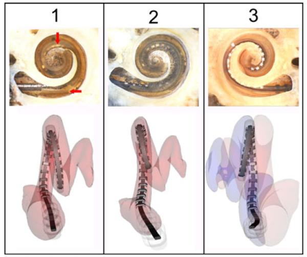 Fig. 11