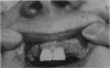 245