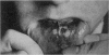 244