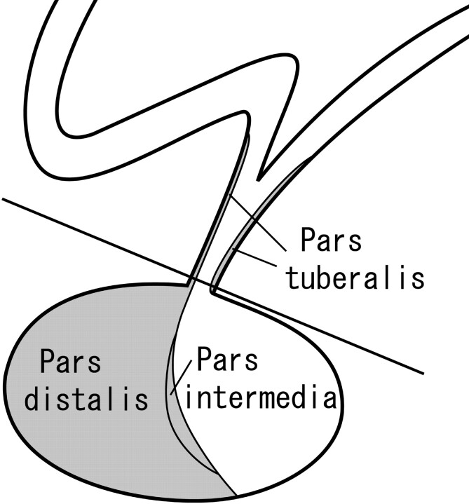 Fig 4.