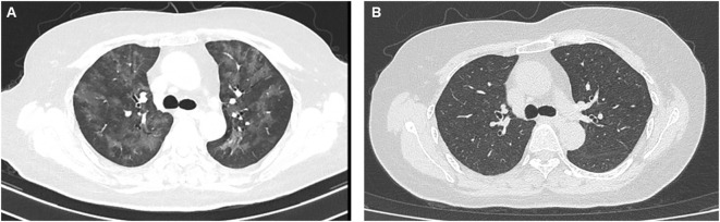 Figure 1