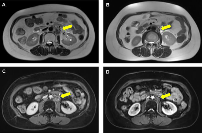 Figure 2