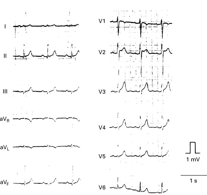 Figure 1  