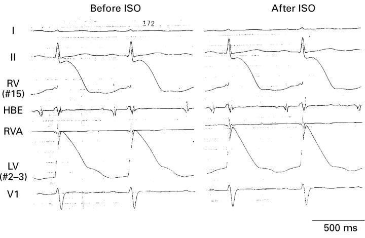 Figure 2  