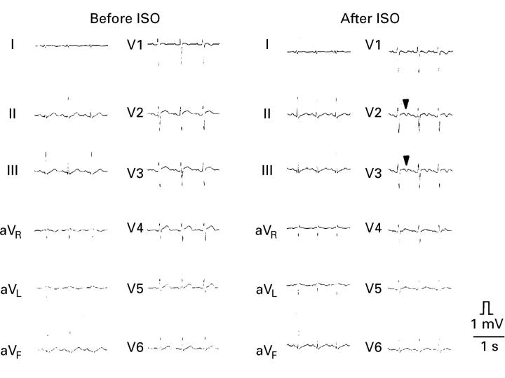 Figure 3  