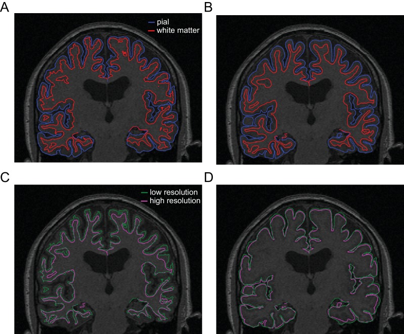 Figure 4—figure supplement 1.