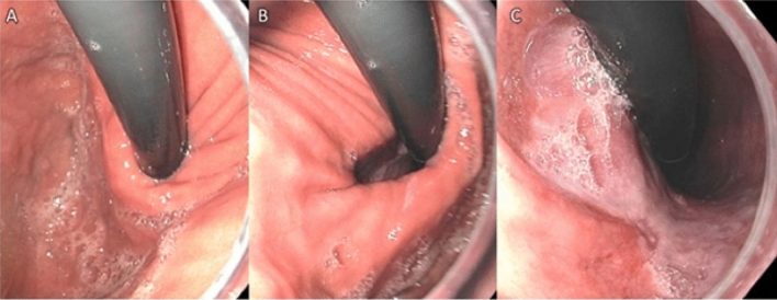 Fig. 5