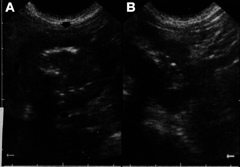 Fig 3.