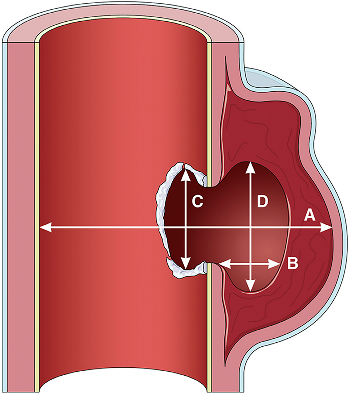 FIGURE 22