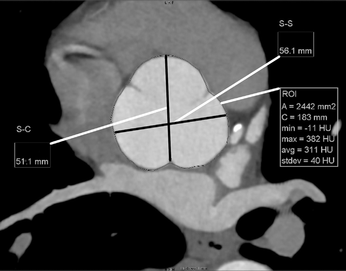 FIGURE 13