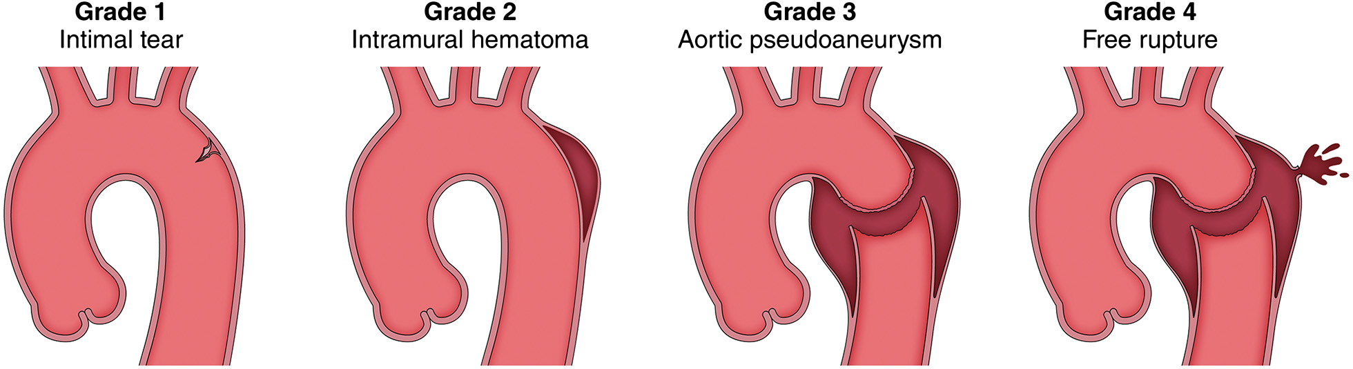 FIGURE 23