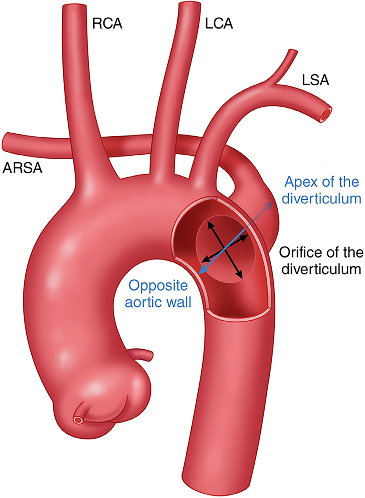 FIGURE 27