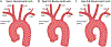 FIGURE 28