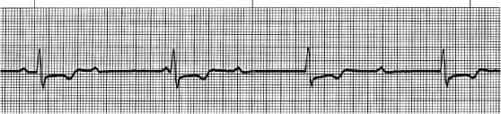 Figure 17