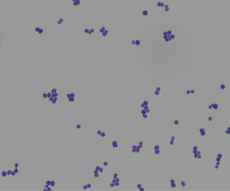 Aerococcus urinae infective endocarditis pmc