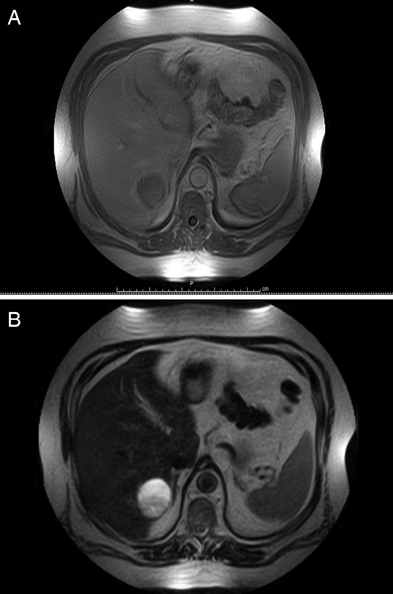 Figure 1