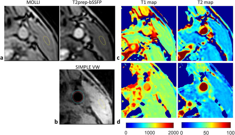 FIG. 4